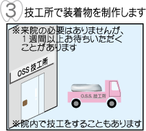 技工所で装着物を製作します